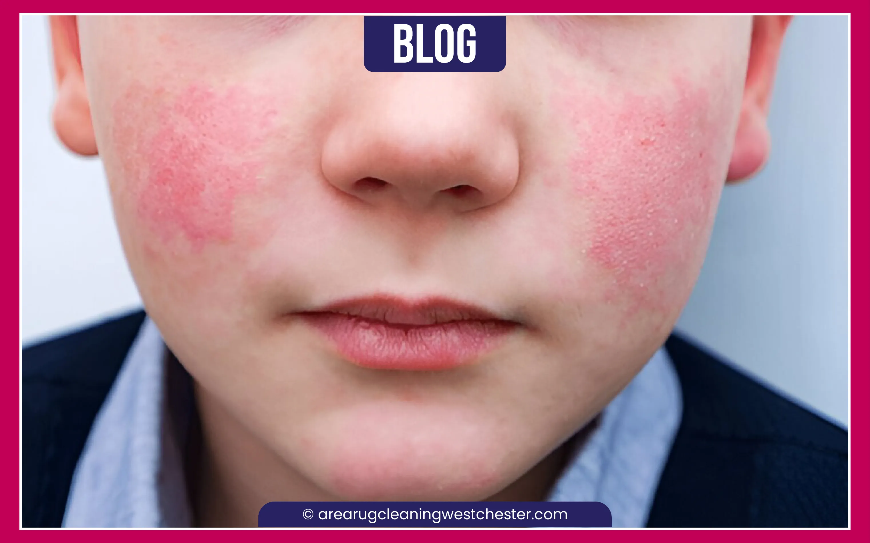 carpet cleaning in Westchester, carpet cleaning in Westchester, carpet cleaning Westchester, carpet cleaners in Westchester, carpet cleaners in Westchester, commercial carpet cleaning, commercial carpet cleaning in Westchester, Westchester rug cleaners, rug cleaning services in Westchester same day carpet cleaning, same day rug cleaning